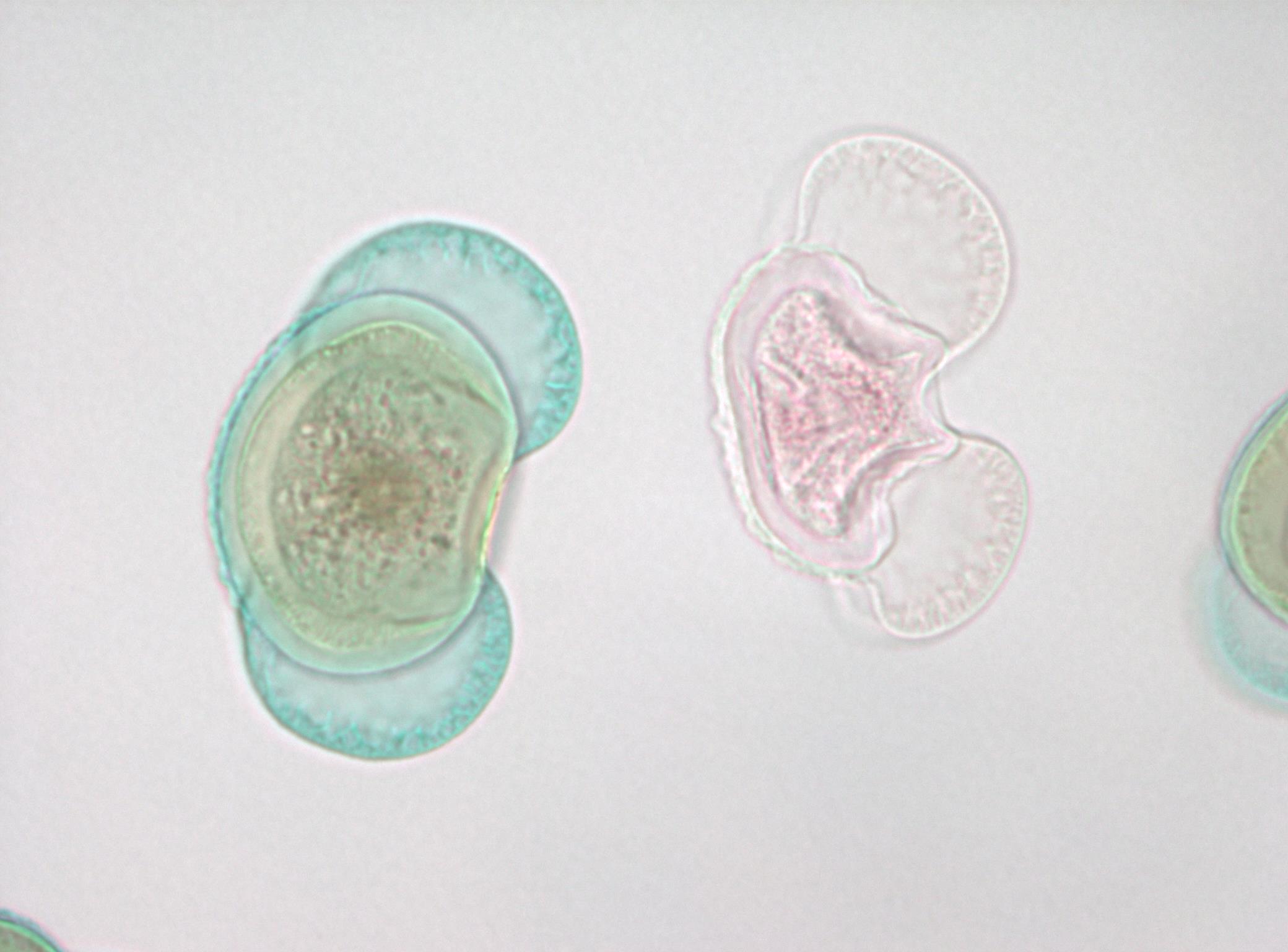 Pine pollen grains viewed under a microscope